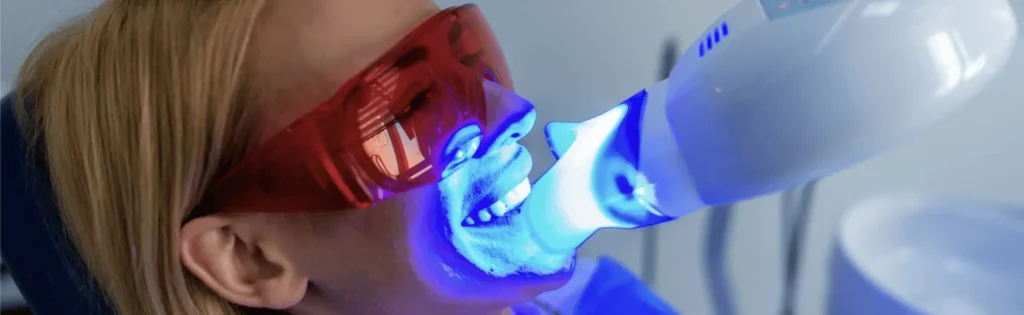 Understanding Teeth Sensitivity After Whitening
