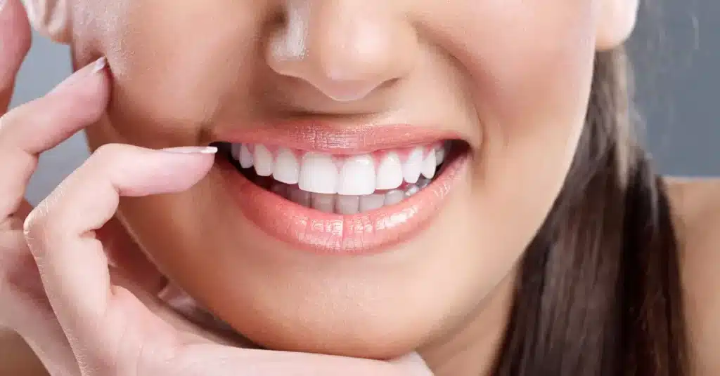 Teeth Whitening: A Complete Guide to a Brighter, Healthier Smile