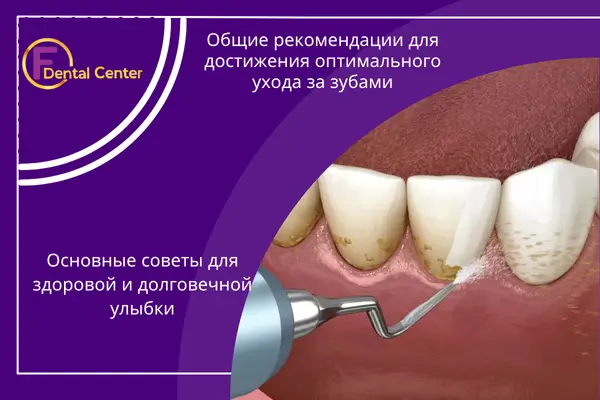 Общие рекомендации по уходу за зубами