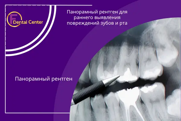 панорамных рентгеновских