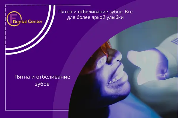 Пятна и отбеливание зубов: Все для более яркой улыбки