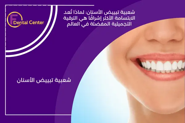 شعبية تبييض الأسنان