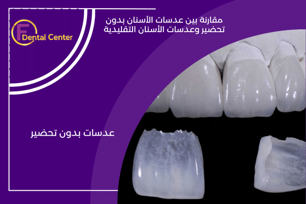 أمراض اللثة المتقدمة: هل الفينير بدون تحضير خيار آمن؟