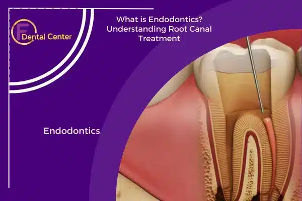 What is Endodontics Understanding Root Canal Treatment