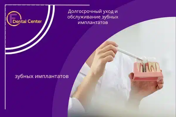 Долгосрочный уход и обслуживание зубных имплантатов