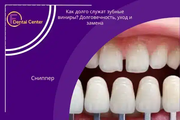 Как долго служат зубные виниры