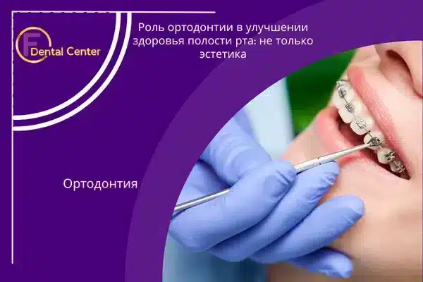 ортодонтии в улучшении здоровья полости рта
