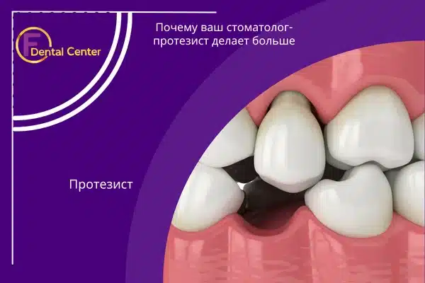 Почему ваш стоматолог-протезист делает больше