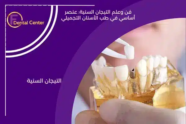 فن وعلم التيجان السنية