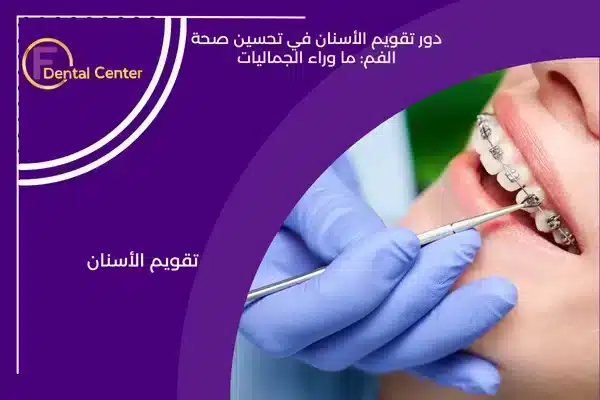 دور تقويم الأسنان في تحسين صحة الفم: ما وراء الجماليات