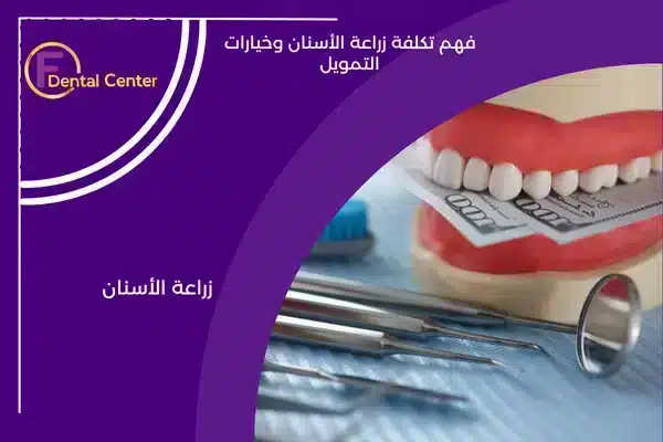 فهم تكلفة زراعة الأسنان