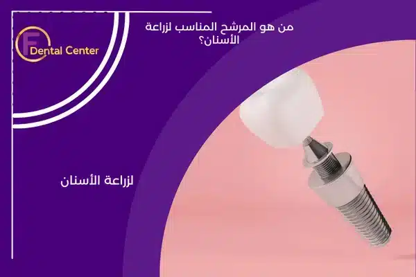من هو المرشح المناسب لزراعة الأسنان؟